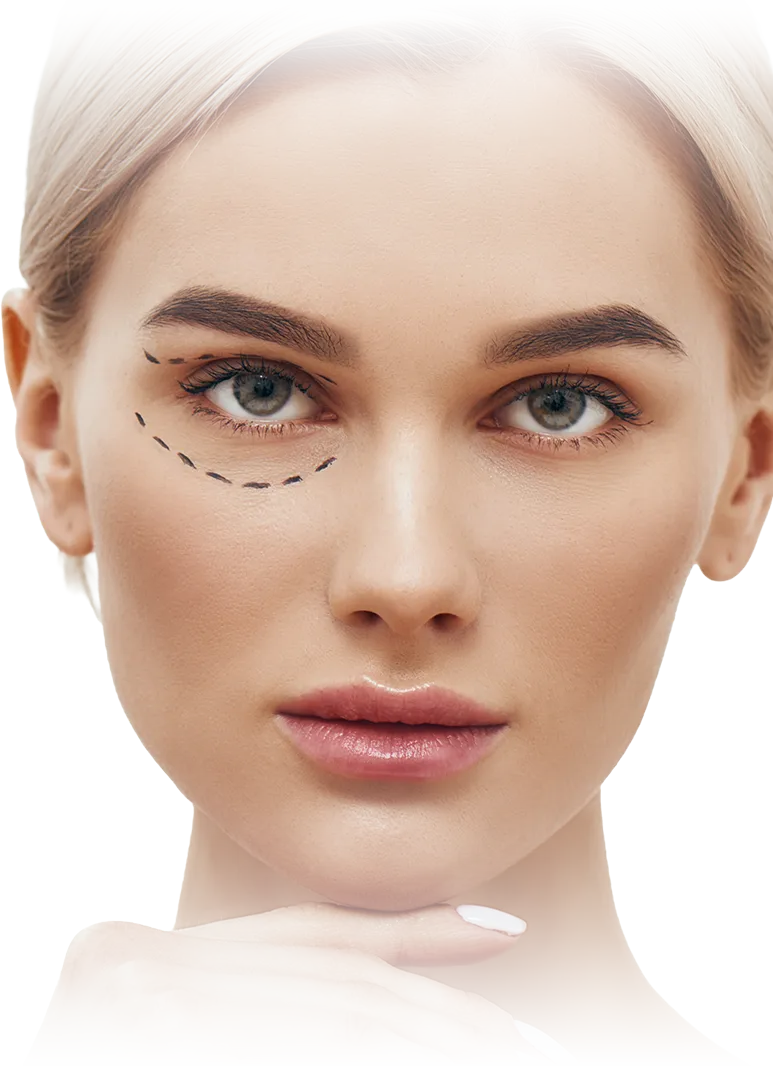Blefaroplastia